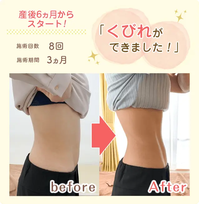 ビフォーアフター